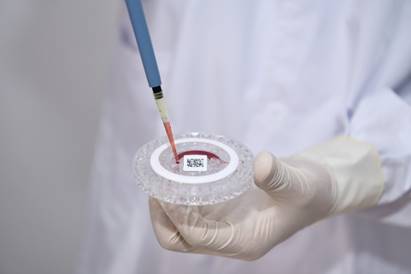 Add 90-120 μL of blood sample