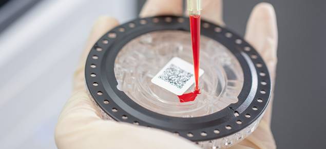 biochemistry blood test